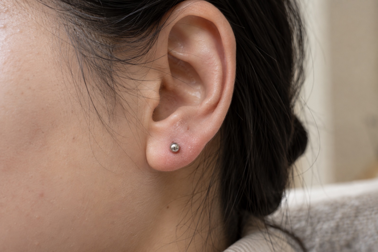 Malapitang kuha mula sa gilid ng tenga ng babaeng nakahawi ang buhok, may pamumula sa paligid ng pilak na bilog na hikaw sa earlobe