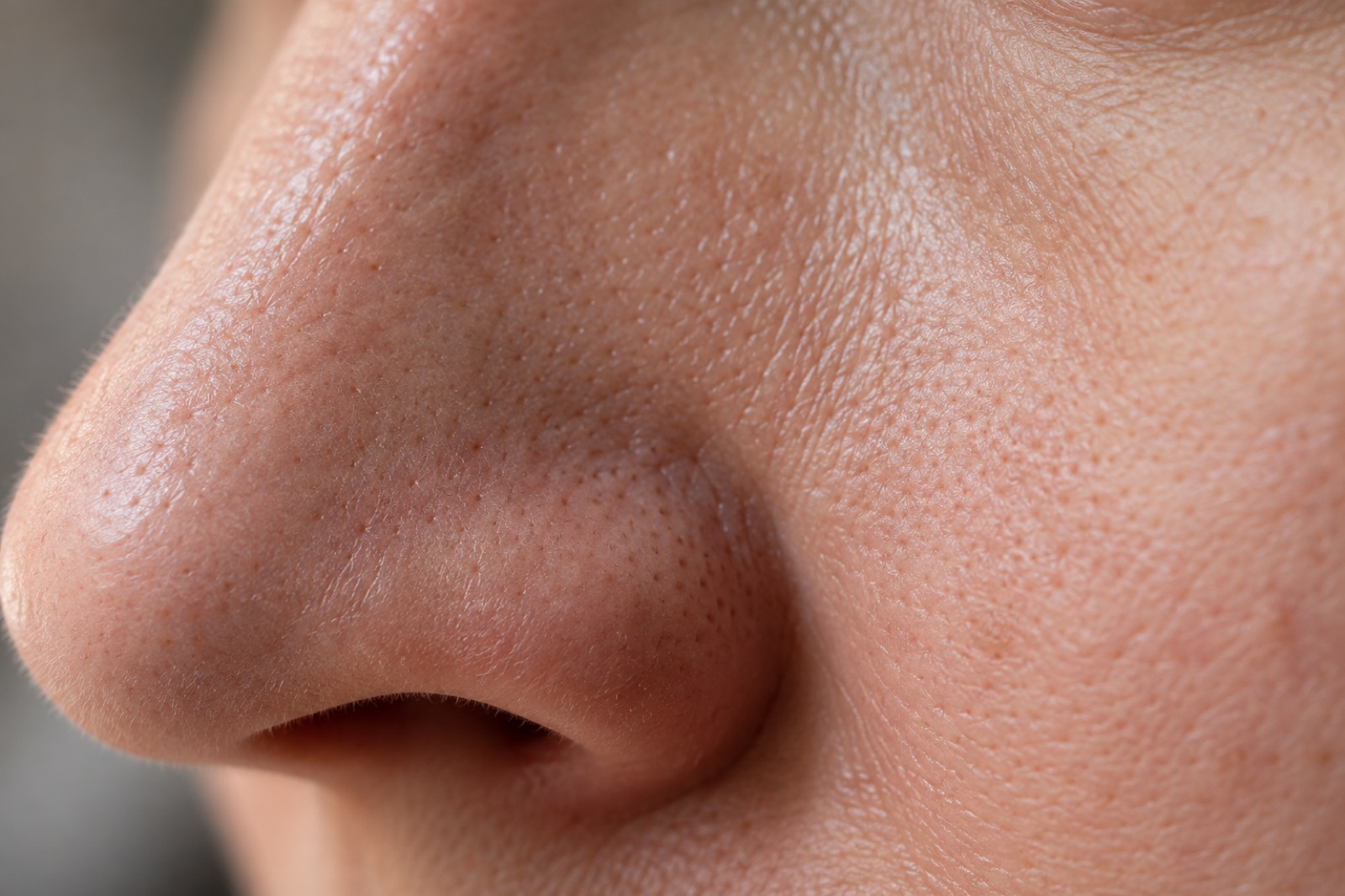 Close side view of the side of the nose and the cheek next to it, with dense pores and fine skin texture clearly visible